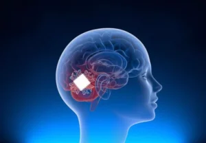 An illustration of a human head in profile with a transparent view of the brain, highlighting a neural implant in the region associated with therapy. This relates to Elon Musk Neuralink spinal cord injury therapy.
