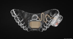 Diagram of a device that use tongue to control the trackpad for an innovative user experience.